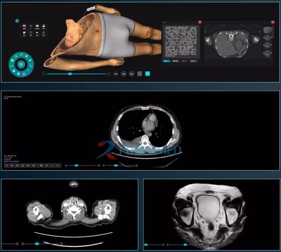Fabrikneuer Anatomage Anatomy 3D Medical für die Schule, digitaler virtueller Autopsietisch